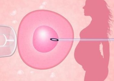 乌克兰第三代试管婴儿获得所有这些需要多少钱？