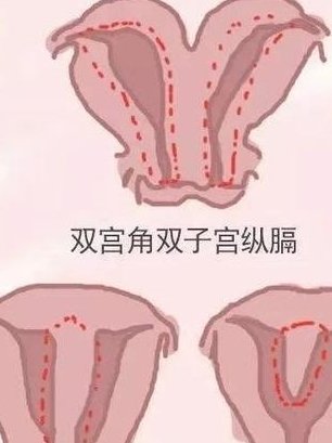 2026年在枣庄去金门金厚生医院做试管的费用贵吗？费用明细介绍